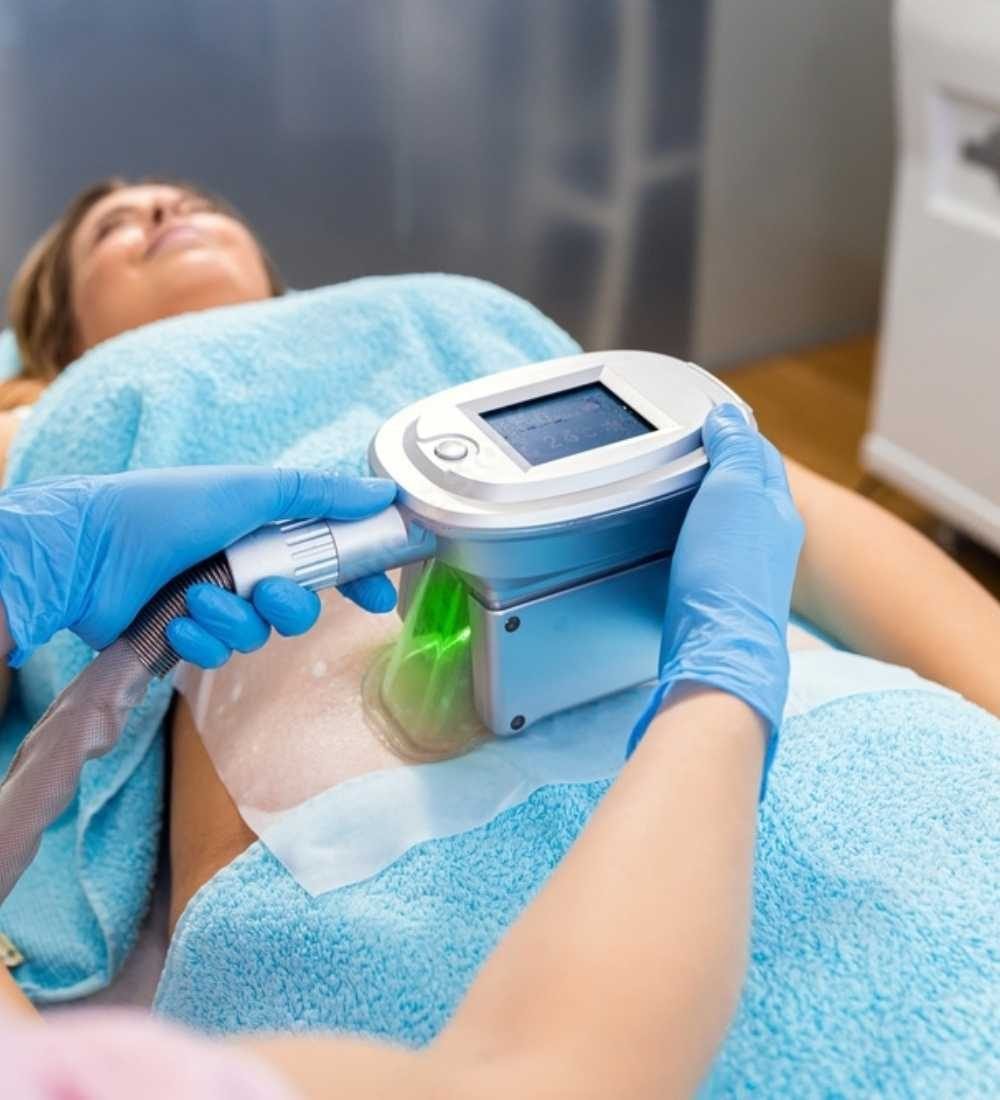 procedimento-rapido-criolipolise